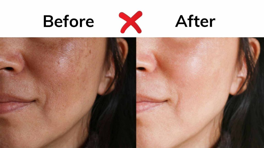 Cấm sử dụng hình ảnh Before - After